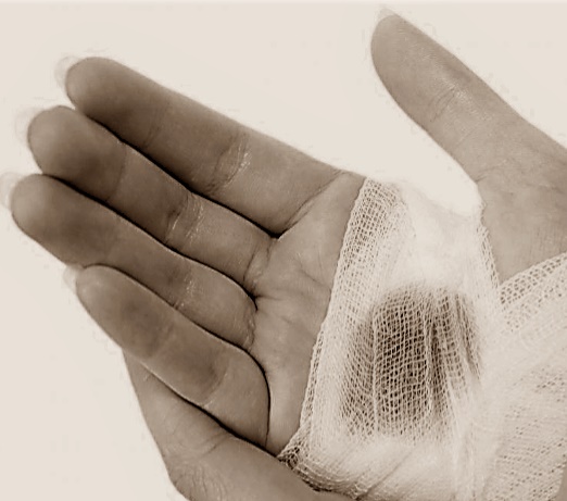 Cleaning and dressing a wound helps it heal faster